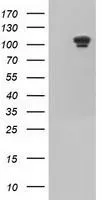 WB analysis of HEK293T cells transfected with USP5 plasmid (Right) or empty vector (Left) for 48 hrs using GTX83430 USP5 antibody [2H5]. Loading : 5 ug per lane