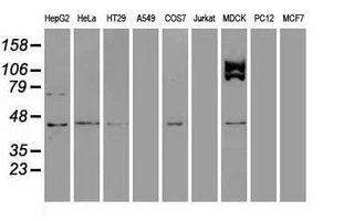 WB analysis of various cell lines using GTX83434 USP38 antibody [1D11]. Loading : 35 ug per lane