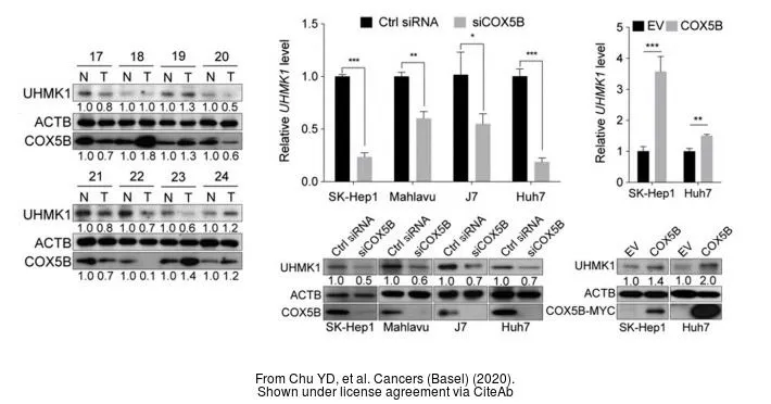 The data was published in the journal Cancers (Basel) in 2020.PMID: 32580279