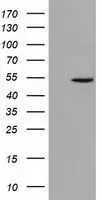 WB analysis of HEK293T cells transfected with UHMK1 plasmid (Right) or empty vector (Left) for 48 hrs using GTX83440 UHMK1 antibody [5E10]. Loading : 5 ug per lane