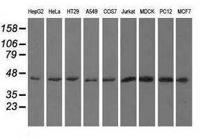 WB analysis of various cell lines using GTX83440 UHMK1 antibody [5E10]. Loading : 35 ug per lane