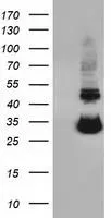 WB analysis of various cell lines using GTX83441 UCK1 antibody [5E9]. Loading : 10 ug per lane Dilution : 1:200