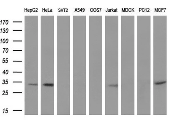 WB analysis of various cell lines using GTX83446 UCK1 antibody [4C2]. Loading : 35 ug per lane Dilution : 1:200