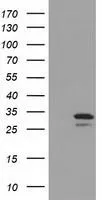 WB analysis of HEK293T cells transfected with UCK1 plasmid (Right) or empty vector (Left) for 48 hrs using GTX83446 UCK1 antibody [4C2]. Loading : 5 ug per lane