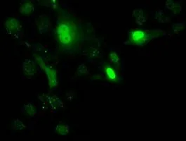 ICC/IF analysis of COS7 cells transiently transfected with UCK1 plasmid using GTX83446 UCK1 antibody [4C2].