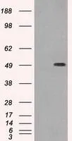 WB analysis of HEK293T cells transfected with beta Tubulin 3/ Tuj1 plasmid (Right) or empty vector (Left) for 48 hrs using GTX83460 beta Tubulin 3/ Tuj1 antibody [5H2]. Loading : 5 ug per lane