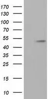WB analysis of HEK293T cells transfected with alpha Tubulin 8 plasmid (Right) or empty vector (Left) for 48 hrs using GTX83461 alpha Tubulin 8 antibody [2C2]. Loading : 5 ug per lane