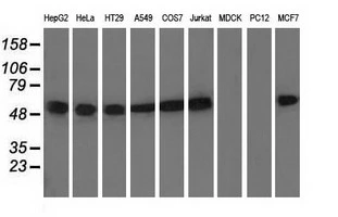 WB analysis of various cell lines using GTX83461 alpha Tubulin 8 antibody [2C2]. Loading : 35 ug per lane