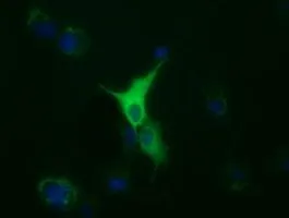 ICC/IF analysis of COS7 cells transiently transfected with alpha Tubulin 8 plasmid using GTX83461 alpha Tubulin 8 antibody [2C2].