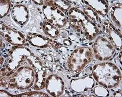 IHC-P analysis of kidney tissue using GTX83463 alpha Tubulin 8 antibody [3E10]. Antigen retrieval : Heat-induced epitope retrieval by 10mM citrate buffer, pH6.0, 100oC for 10min. Dilution : 1:50