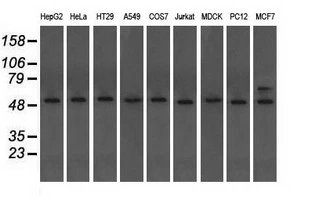WB analysis of various cell lines using GTX83463 alpha Tubulin 8 antibody [3E10]. Loading : 35 ug per lane