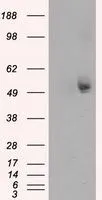 WB analysis of HEK293T cells transfected with alpha Tubulin 8 plasmid (Right) or empty vector (Left) for 48 hrs using GTX83463 alpha Tubulin 8 antibody [3E10]. Loading : 5 ug per lane