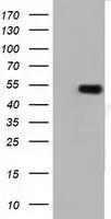 WB analysis of HEK293T cells transfected with TUBA3E plasmid (Right) or empty vector (Left) for 48 hrs using GTX83465 TUBA3E antibody [10B4]. Loading : 5 ug per lane
