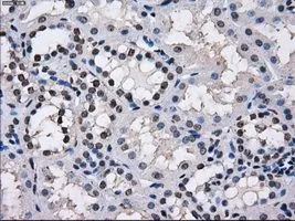 IHC-P analysis of kidney tissue using GTX83469 TTLL12 antibody [7F11]. Antigen retrieval : Heat-induced epitope retrieval by 10mM citrate buffer, pH6.0, 100oC for 10min. Dilution : 1:50