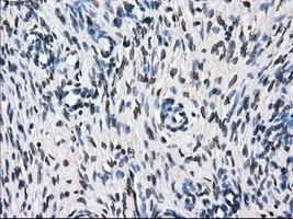 IHC-P analysis of ovary tissue using GTX83469 TTLL12 antibody [7F11]. Antigen retrieval : Heat-induced epitope retrieval by 10mM citrate buffer, pH6.0, 100oC for 10min. Dilution : 1:50
