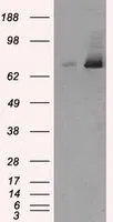 WB analysis of HEK293T cells transfected with TTLL12 plasmid (Right) or empty vector (Left) for 48 hrs using GTX83469 TTLL12 antibody [7F11]. Loading : 5 ug per lane