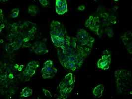 ICC/IF analysis of HepG2 cells using GTX83469 TTLL12 antibody [7F11].