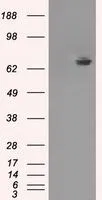 WB analysis of HEK293T cells transfected with TTLL12 plasmid (Right) or empty vector (Left) for 48 hrs using GTX83471 TTLL12 antibody [12B7]. Loading : 5 ug per lane