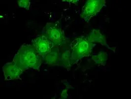 ICC/IF analysis of COS7 cells transiently transfected with TTLL12 plasmid using GTX83471 TTLL12 antibody [12B7].