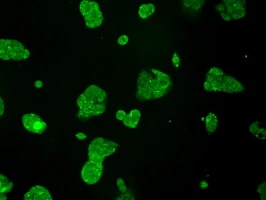 ICC/IF analysis of HepG2 cells using GTX83471 TTLL12 antibody [12B7].