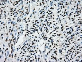 IHC-P analysis of endometrium tissue using GTX83473 TTLL12 antibody [4B2]. Antigen retrieval : Heat-induced epitope retrieval by 10mM citrate buffer, pH6.0, 100oC for 10min. Dilution : 1:50