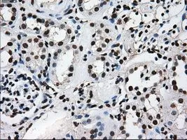 IHC-P analysis of kidney tissue using GTX83473 TTLL12 antibody [4B2]. Antigen retrieval : Heat-induced epitope retrieval by 10mM citrate buffer, pH6.0, 100oC for 10min. Dilution : 1:50