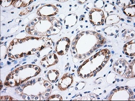 IHC-P analysis of human kidney tissue using GTX83482 TTC32 antibody [5C12]. Antigen retrieval : Heat-induced epitope retrieval by 10mM citrate buffer, pH6.0, 100oC for 10min. Dilution : 1:50