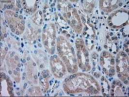 IHC-P analysis of human kidney tissue using GTX83489 TRPM4 antibody [10H5]. Antigen retrieval : Heat-induced epitope retrieval by 10mM citrate buffer, pH6.0, 100oC for 10min.
