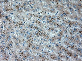 IHC-P analysis of human liver tissue using GTX83489 TRPM4 antibody [10H5]. Antigen retrieval : Heat-induced epitope retrieval by 10mM citrate buffer, pH6.0, 100oC for 10min.