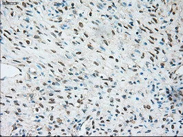 IHC-P analysis of human ovary tissue using GTX83489 TRPM4 antibody [10H5]. Antigen retrieval : Heat-induced epitope retrieval by 10mM citrate buffer, pH6.0, 100oC for 10min.