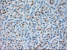 IHC-P analysis of human pancreas tissue using GTX83489 TRPM4 antibody [10H5]. Antigen retrieval : Heat-induced epitope retrieval by 10mM citrate buffer, pH6.0, 100oC for 10min.
