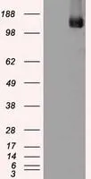 WB analysis of HEK293T cells transfected with TRPM4 plasmid (Right) or empty vector (Left) for 48 hrs using GTX83489 TRPM4 antibody [10H5]. Loading : 5 ug per lane