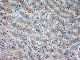 IHC-P analysis of liver tissue using GTX83491 TRPM4 antibody [14C3]. Antigen retrieval : Heat-induced epitope retrieval by 10mM citrate buffer, pH6.0, 100oC for 10min. Dilution : 1:50