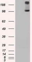 WB analysis of HEK293T cells transfected with TRPM4 plasmid (Right) or empty vector (Left) for 48 hrs using GTX83491 TRPM4 antibody [14C3]. Loading : 5 ug per lane