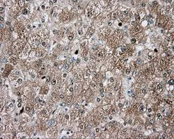 IHC-P analysis of liver tissue using GTX83497 TPMT antibody [4C1]. Antigen retrieval : Heat-induced epitope retrieval by 10mM citrate buffer, pH6.0, 100oC for 10min. Dilution : 1:50