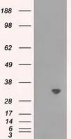 WB analysis of HEK293T cells transfected with TPMT plasmid (Right) or empty vector (Left) for 48 hrs using GTX83497 TPMT antibody [4C1]. Loading : 5 ug per lane