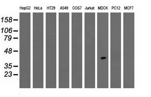 WB analysis of various cell lines using GTX83497 TPMT antibody [4C1]. Loading : 35 ug per lane