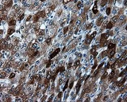 IHC-P analysis of liver tissue using GTX83498 TPMT antibody [2A2]. Antigen retrieval : Heat-induced epitope retrieval by 10mM citrate buffer, pH6.0, 100oC for 10min. Dilution : 1:50