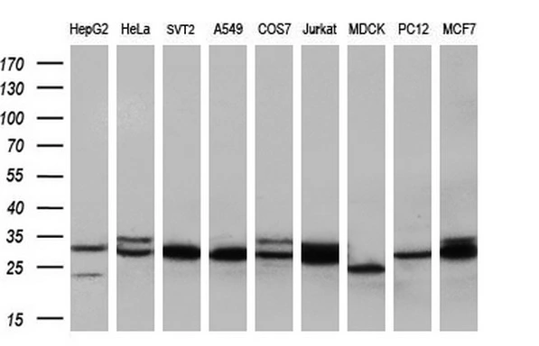 WB analysis of various cell lines using GTX83498 TPMT antibody [2A2]. Loading : 35 ug per lane Dilution : 1:200