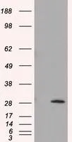 WB analysis of HEK293T cells transfected with TPMT plasmid (Right) or empty vector (Left) for 48 hrs using GTX83498 TPMT antibody [2A2]. Loading : 5 ug per lane