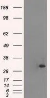 WB analysis of HEK293T cells transfected with Cardiac Troponin I plasmid (Right) or empty vector (Left) for 48 hrs using GTX83501 Cardiac Troponin I antibody [4A3]. Loading : 5 ug per lane
