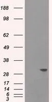 WB analysis of HEK293T cells transfected with Cardiac Troponin I plasmid (Right) or empty vector (Left) for 48 hrs using GTX83502 Cardiac Troponin I antibody [3G2]. Loading : 5 ug per lane