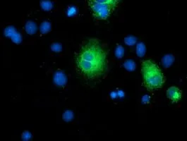 ICC/IF analysis of COS7 cells transiently transfected with TMEM80 plasmid using GTX83505 TMEM80 antibody [3B6].