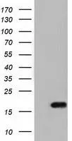 WB analysis of HEK293T cells transfected with TMEM80 plasmid (Right) or empty vector (Left) for 48 hrs using GTX83506 TMEM80 antibody [2B7]. Loading : 5 ug per lane