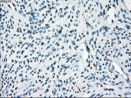 IHC-P analysis of human endometrium tissue using GTX83508 TMEM100 antibody [10G3]. Antigen retrieval : Heat-induced epitope retrieval by 10mM citrate buffer, pH6.0, 100oC for 10min.