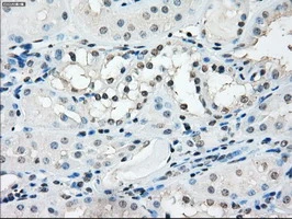 IHC-P analysis of human kidney tissue using GTX83508 TMEM100 antibody [10G3]. Antigen retrieval : Heat-induced epitope retrieval by 10mM citrate buffer, pH6.0, 100oC for 10min.