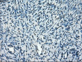 IHC-P analysis of human ovary tissue using GTX83508 TMEM100 antibody [10G3]. Antigen retrieval : Heat-induced epitope retrieval by 10mM citrate buffer, pH6.0, 100oC for 10min.