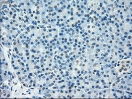 IHC-P analysis of human pancreas tissue using GTX83508 TMEM100 antibody [10G3]. Antigen retrieval : Heat-induced epitope retrieval by 10mM citrate buffer, pH6.0, 100oC for 10min.