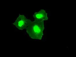 ICC/IF analysis of COS7 cells transiently transfected with TMEM100 plasmid using GTX83508 TMEM100 antibody [10G3].