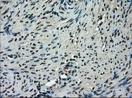 IHC-P analysis of endometrium tissue using GTX83509 TMEM100 antibody [2D3]. Antigen retrieval : Heat-induced epitope retrieval by 10mM citrate buffer, pH6.0, 100oC for 10min. Dilution : 1:50
